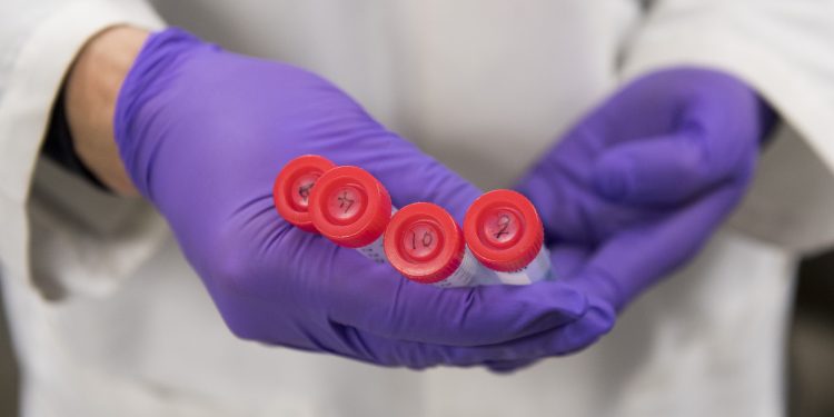 COVID-19: Health researcher says he believes Omicron variant could be the end of the dreaded coronavirus